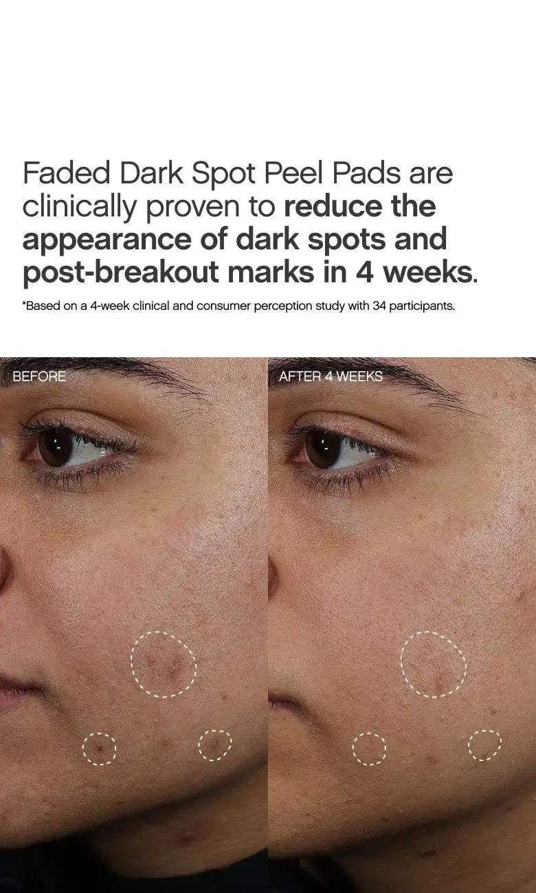 Faded Dark Spot Peel Pads