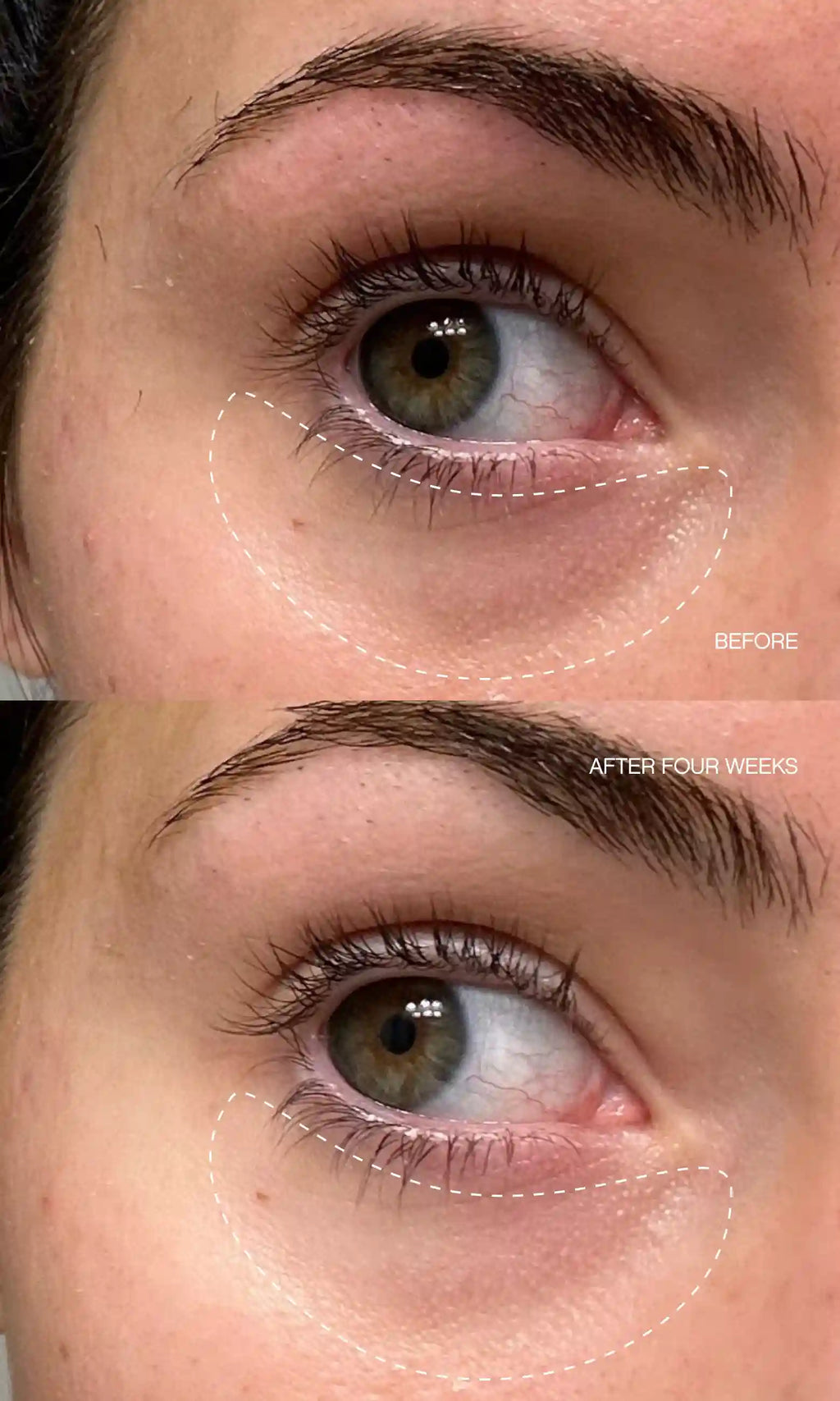 Faded Complete Dark Spot Bundle