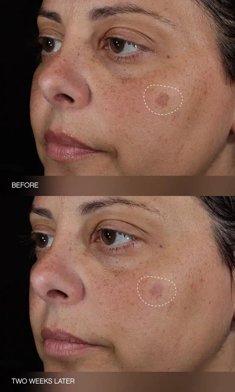 Faded Complete Dark Spot Bundle