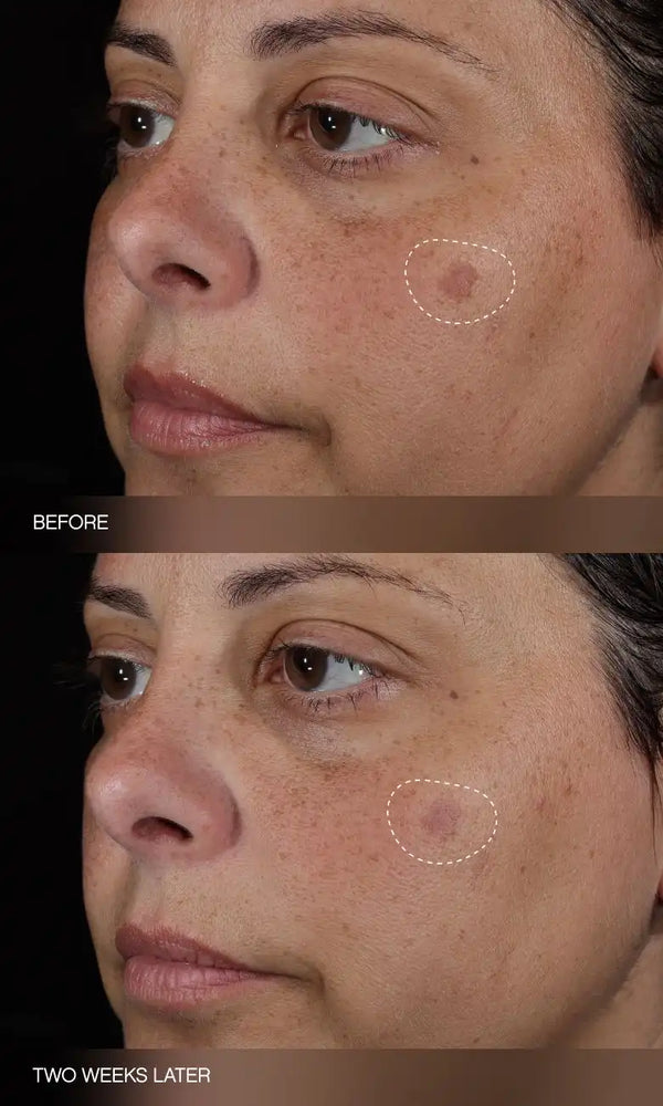 Faded Complete Dark Spot Bundle