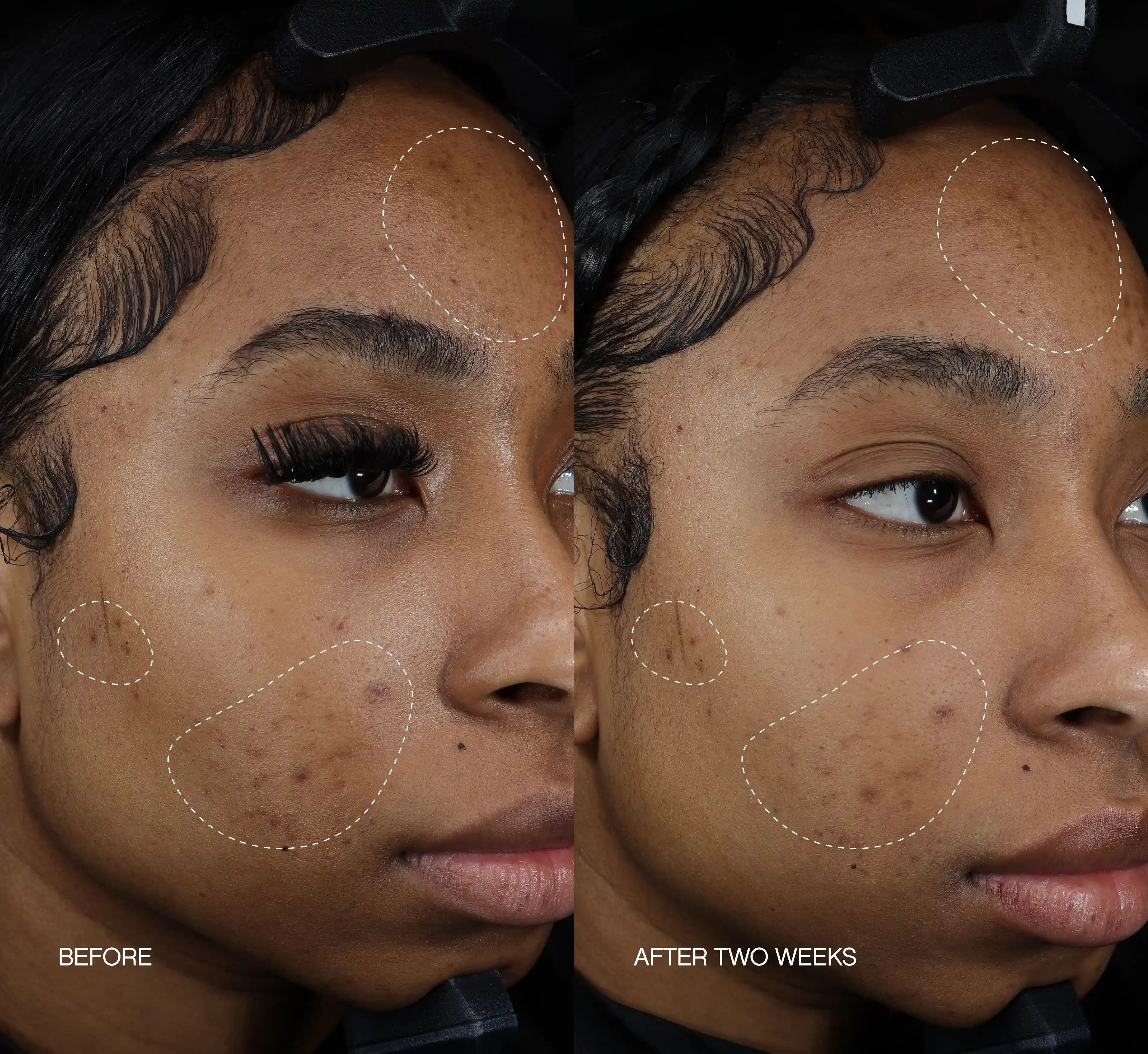 Discoloration Duo Secondary image