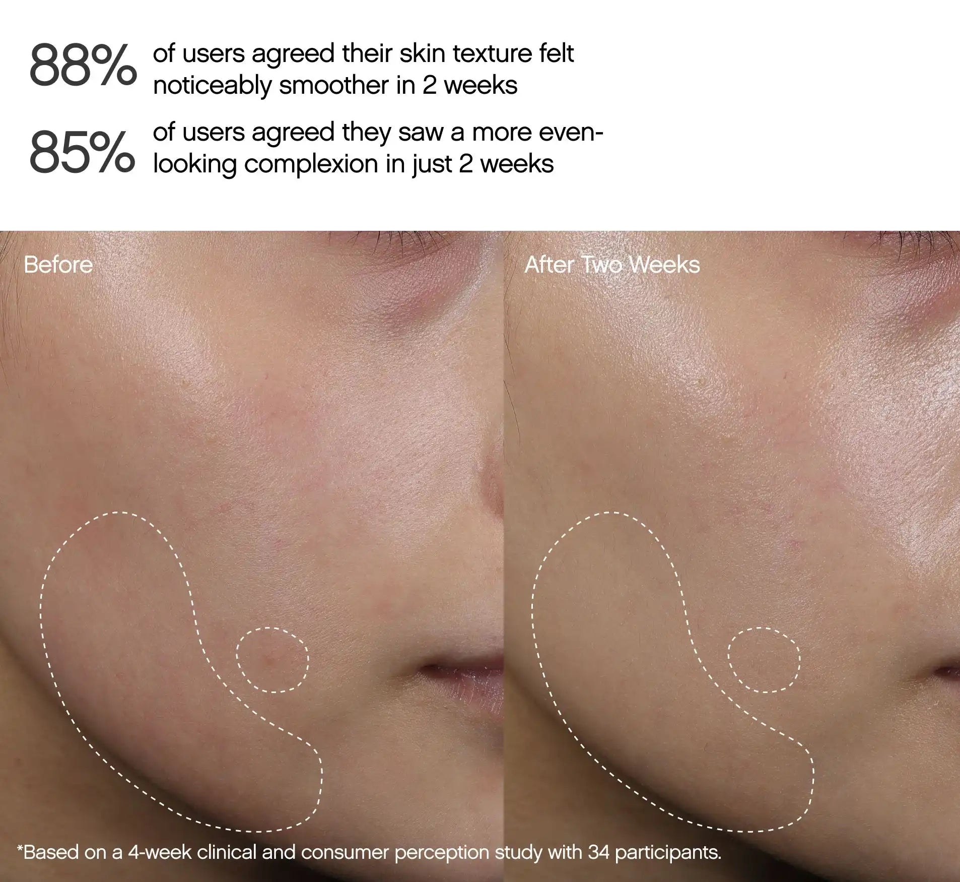 Faded Dark Spot Peel Pads Secondary image