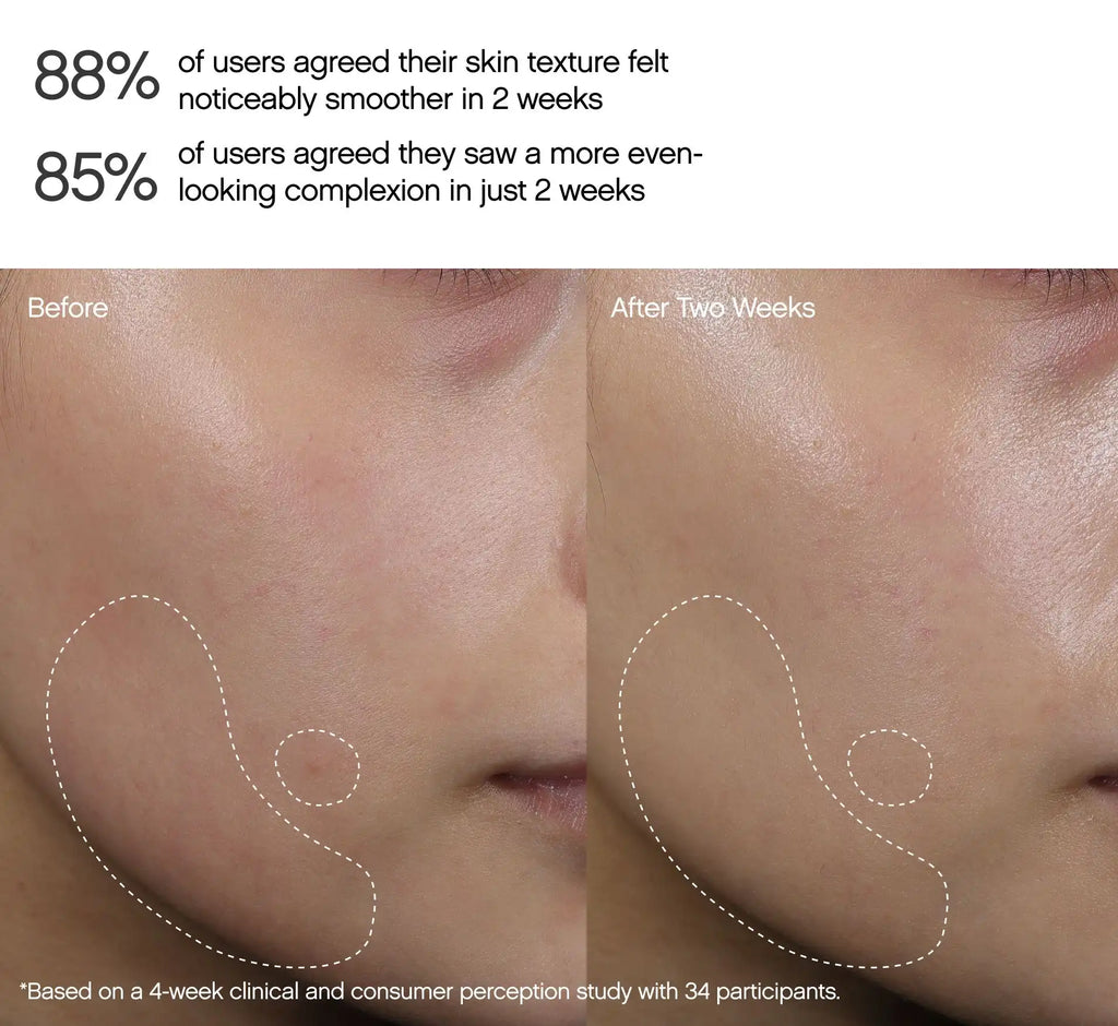 Faded Dark Spot Peel Pads