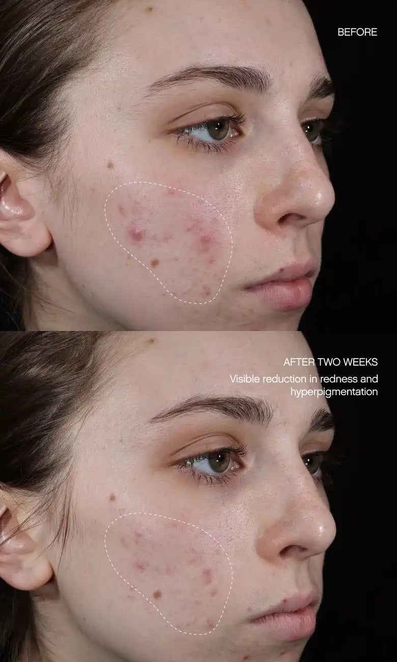 Faded Brightening + Clearing Serum