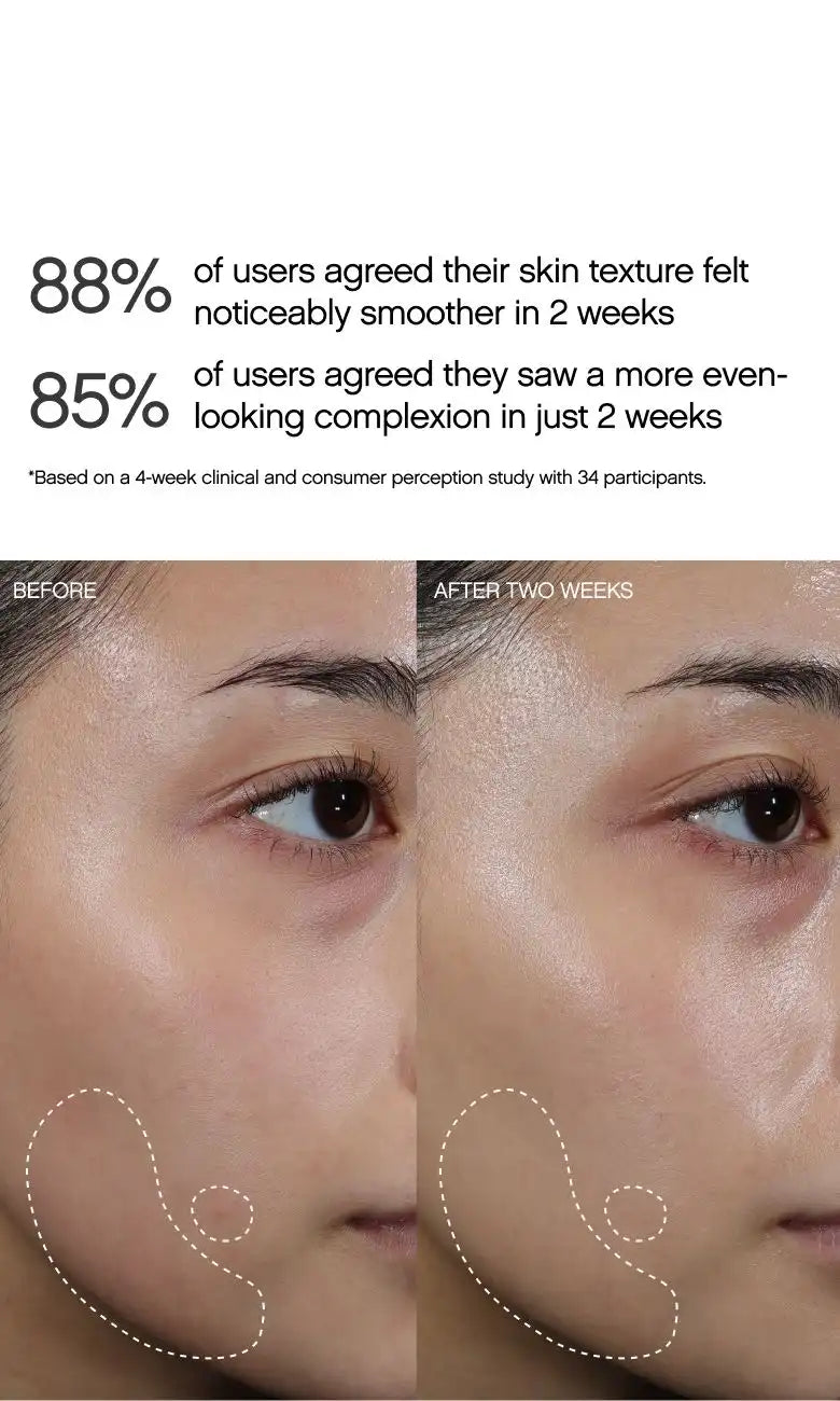 Faded Dark Spot Peel Pads