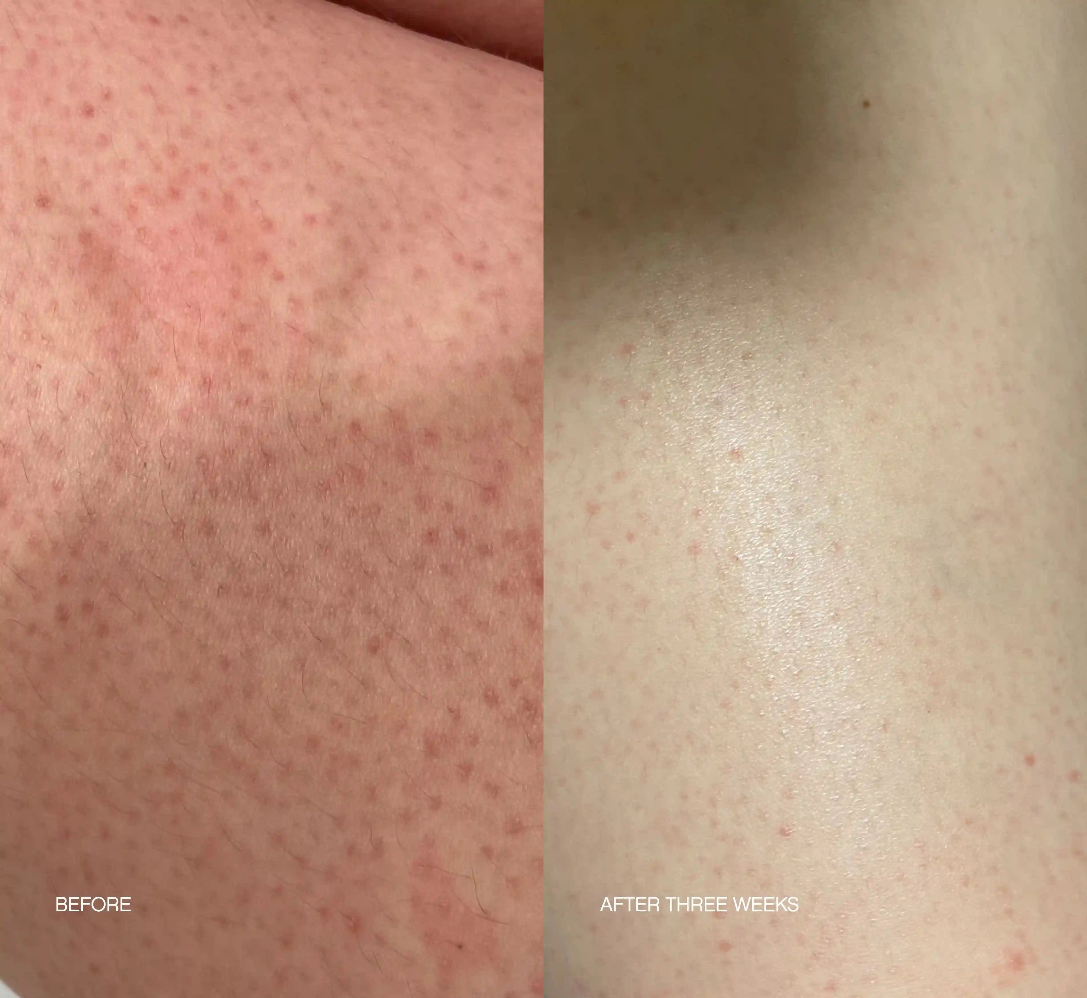 Slather Exfoliating Body Serum Secondary image