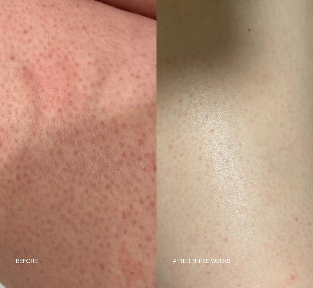 Slather Exfoliating Body Serum