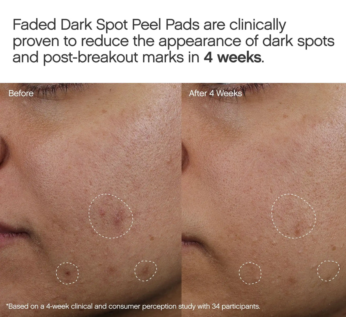 Faded Dark Spot Peel Pads