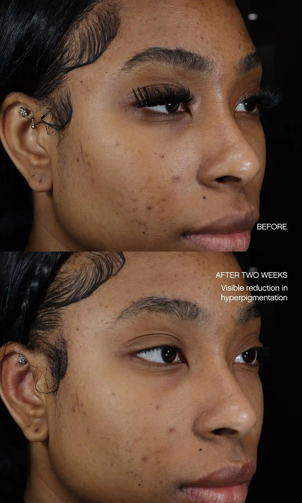Faded Brightening + Clearing Serum