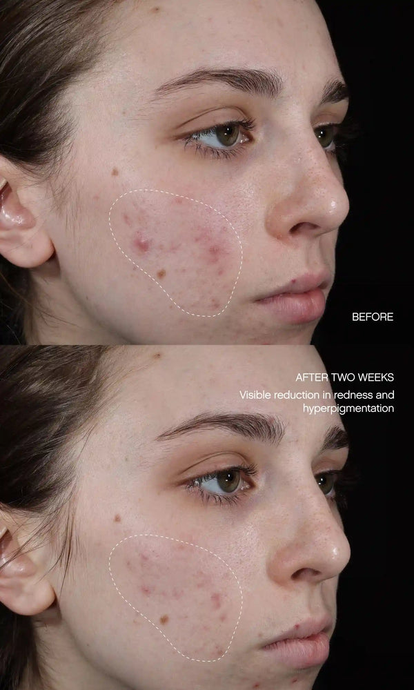 Faded Serum (Original Formula)