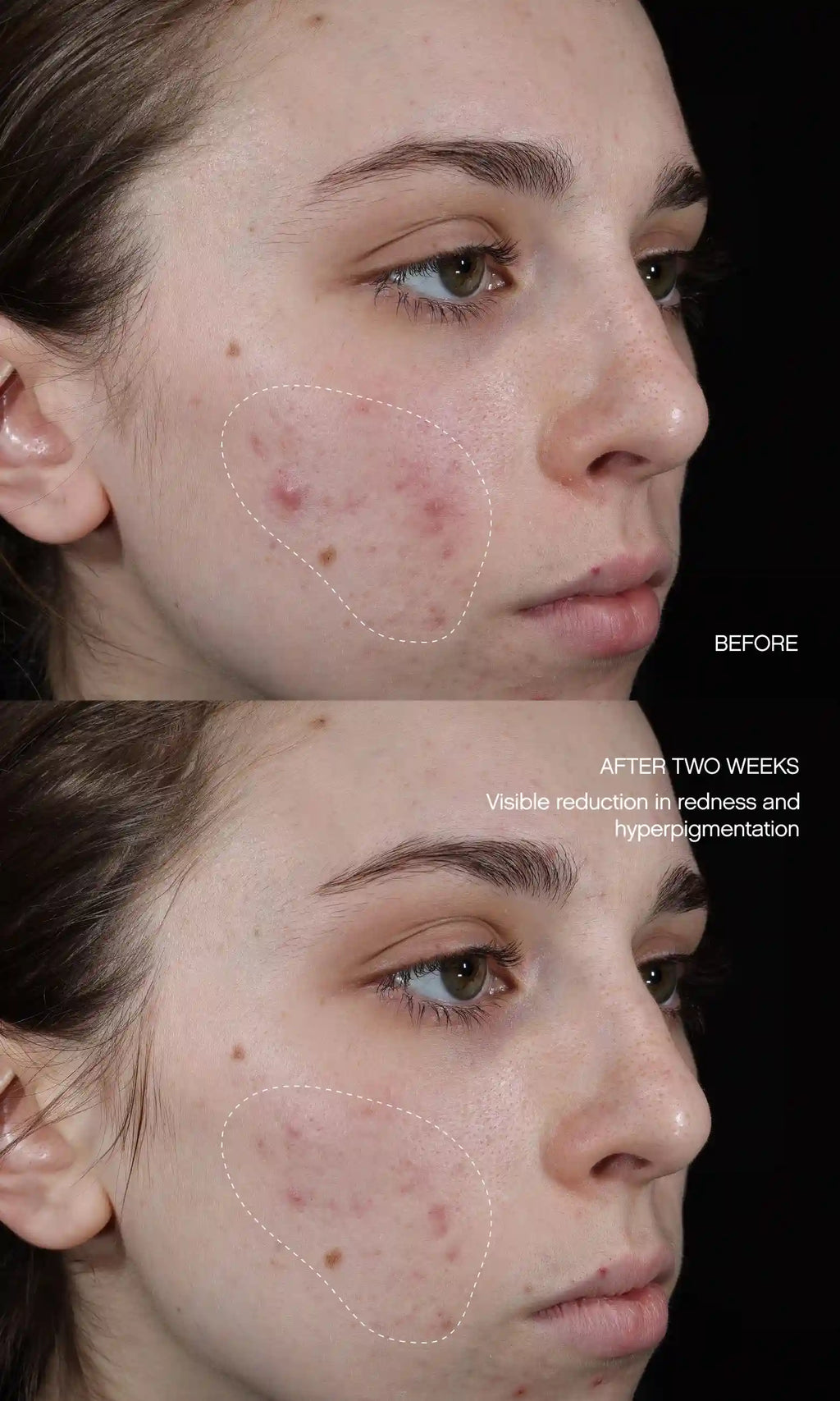 Faded Brightening + Clearing Serum